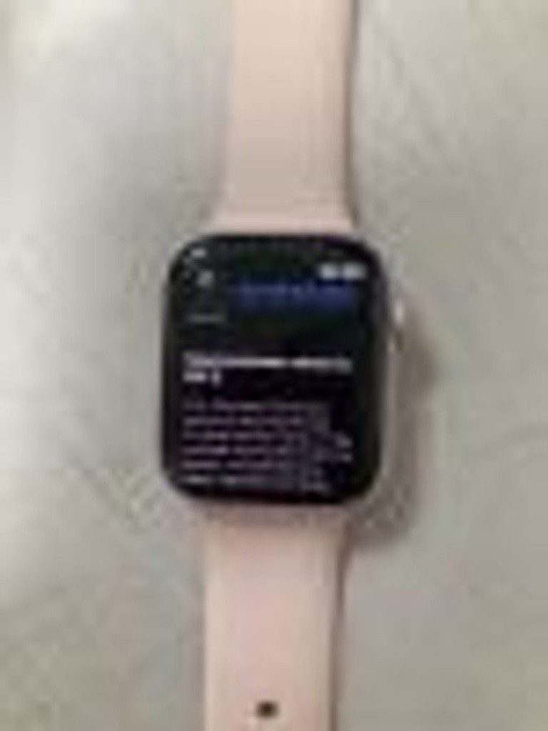 Дешево Apple watch series 9 gps 45mm aluminum case з ломбарду