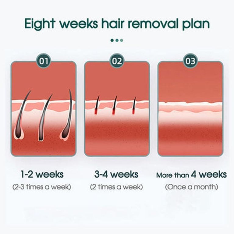 Lumisilk Lumina IPL PRO, Pulsed Light Код:null. Изображение 10