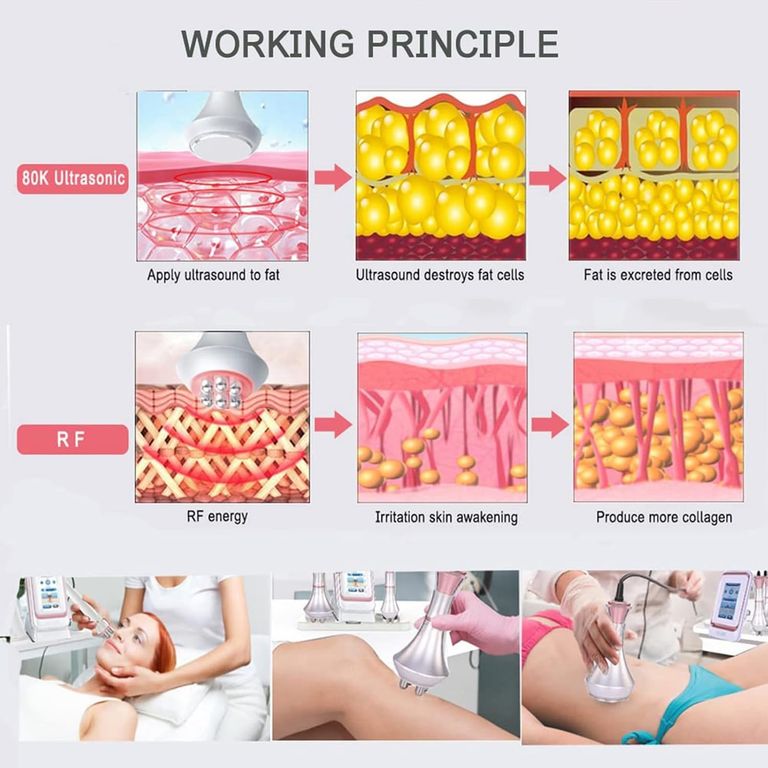 Ультразвукова кавітаційна машина OSMARI 80K, 4-в-1 радіочастотна ультразвукова машина для формування Код:null. Зображення 6