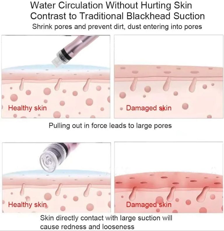 вакуумне відсмоктування  Код:null. Изображение 9